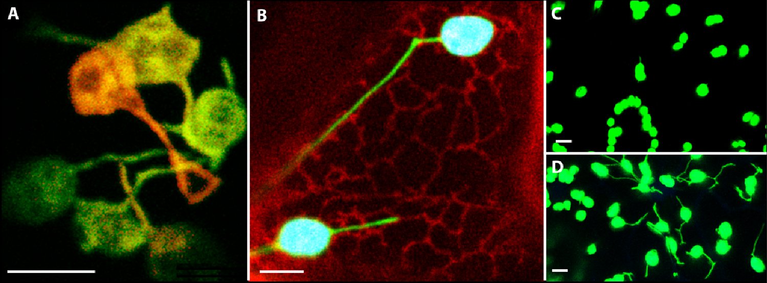 Figure: (A) Recent discoveries show that stromules do not interconnect independent plastids
(Schattat et al., 2012). (B) This emphasises the increase of interactive surface to other organelles
as their main function (Schattat et al., 2011). Stromules before (C) and after (D) induction. (size bars correspond to 10m)
